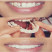 Snap on Smile в Санкт-Петербурге