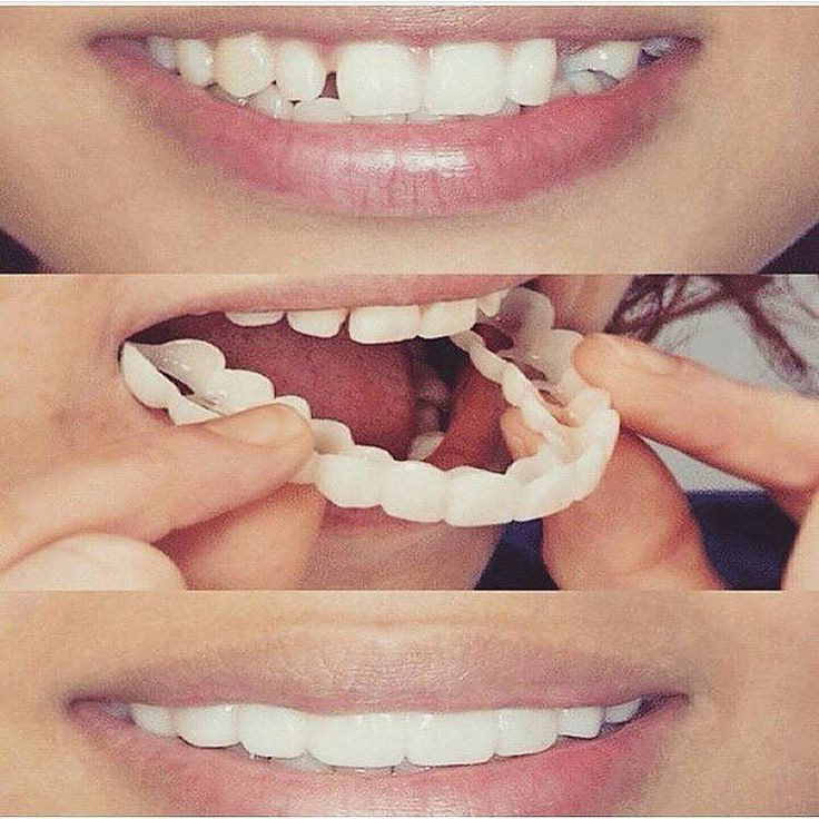 Snap on Smile в Санкт-Петербурге
