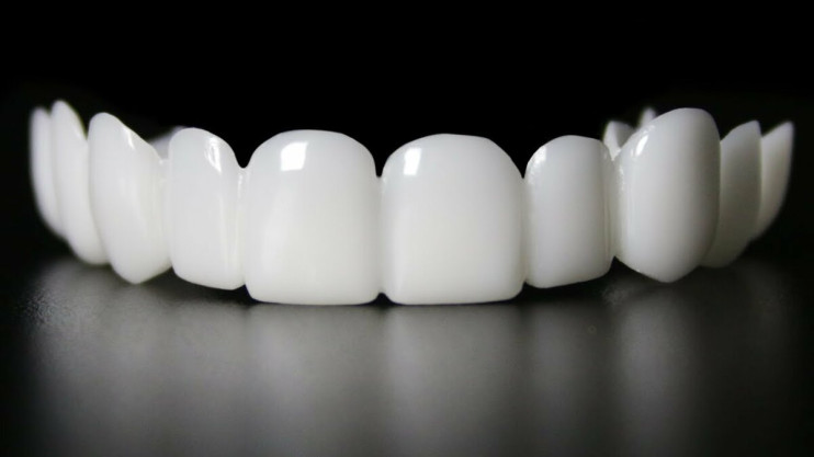 Snap on Smile в Санкт-Петербурге