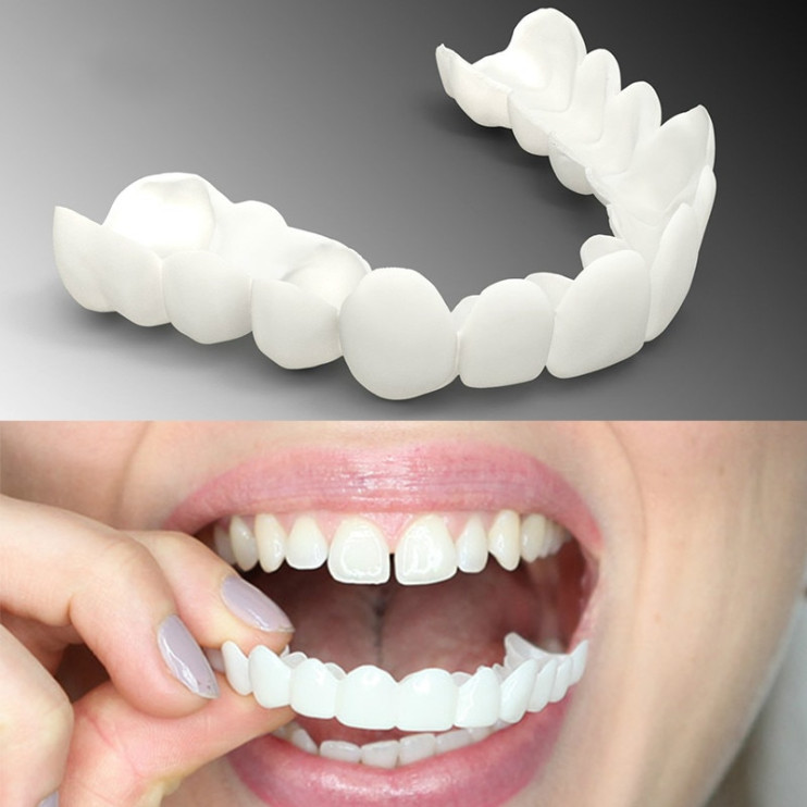 Snap on Smile в Санкт-Петербурге