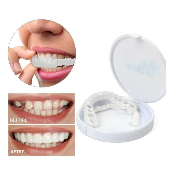 Snap on Smile в Санкт-Петербурге