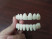 TruSmile Veneers в Вологде
