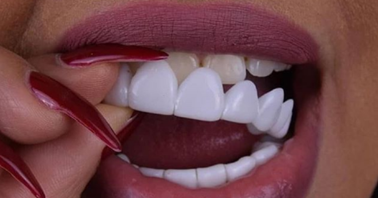 Snap on Smile в Мурманске в Мурманске