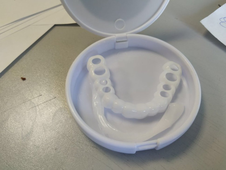 TruSmile Veneers в Санкт-Петербурге