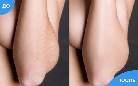 Жидкий лазер в Нижнем Новгороде